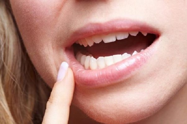 Nằm mơ thấy răng lung lay có ý nghĩa gì?