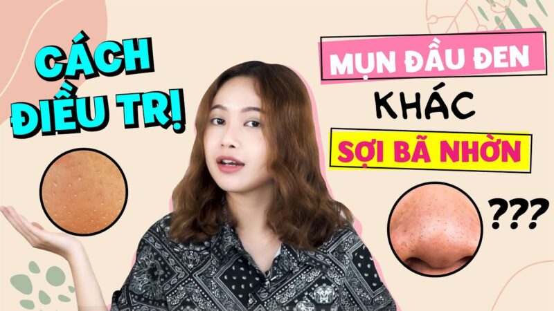 Mụn đầu đen là gì?Nguyên nhân gây mụn đầu đen và giải pháp trị mụn an toàn Làm thế nào để điều trị mụn đầu đen